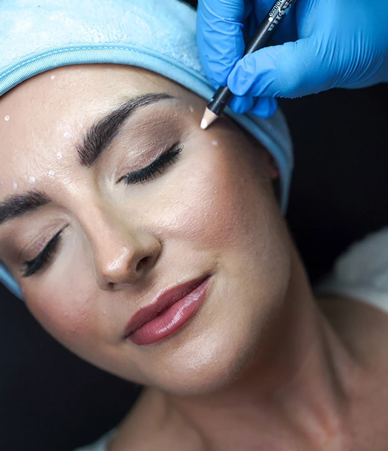 Botox treatment at Face Forward Aesthetics